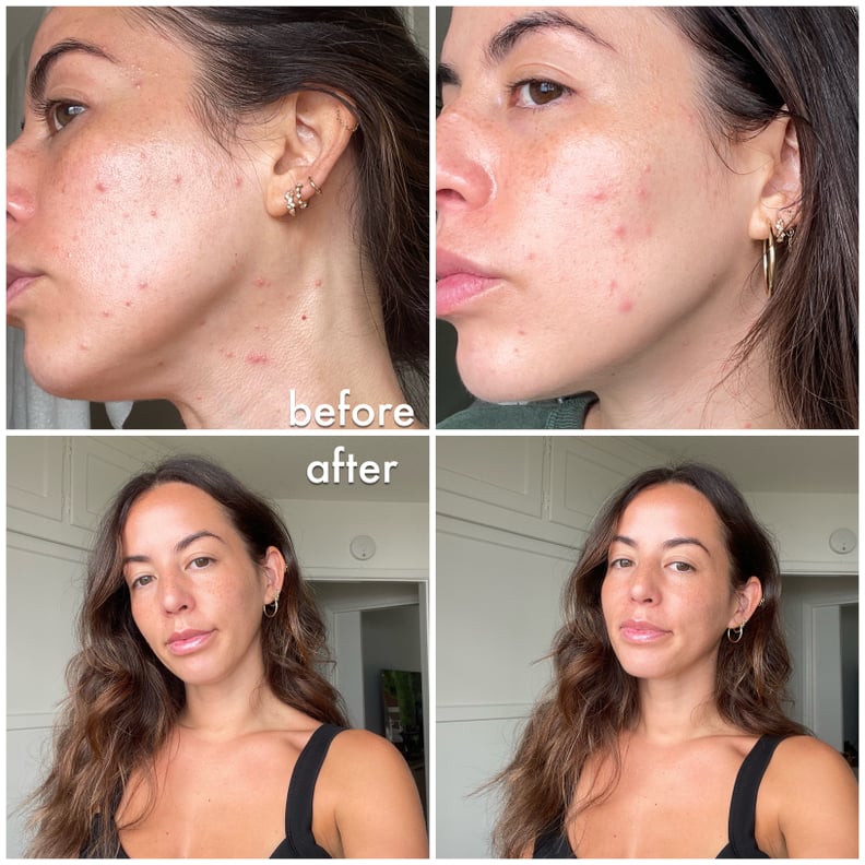 SkinMedica TNS Ceramide Treatment Cream Editor Review
