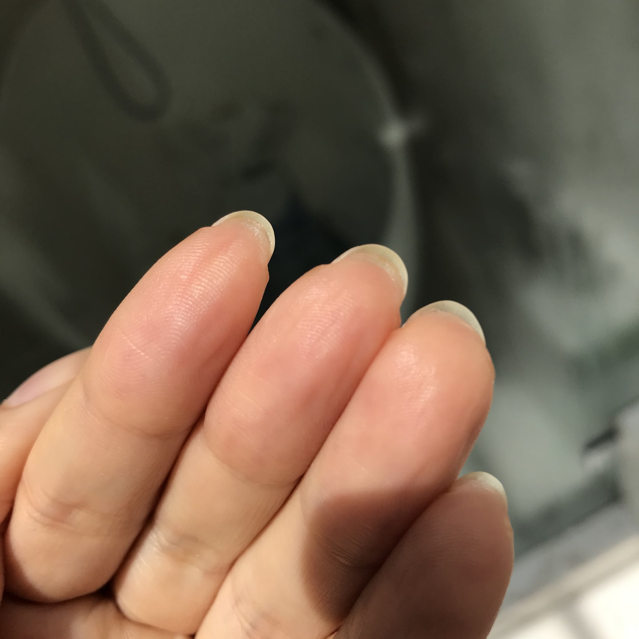 Any ideas why my thumb nail keeps getting these stripes? How do i fix it? :  r/TheGirlSurvivalGuide