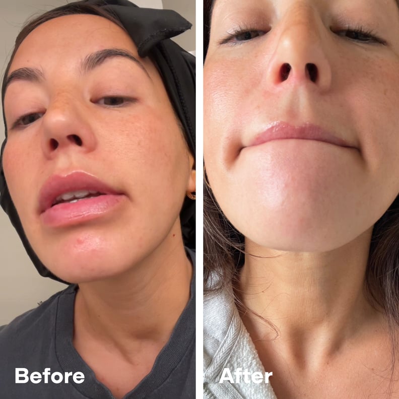 A313 Before and After