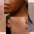 What Is Your Skin Type? Take This Easy Quiz to Find Out