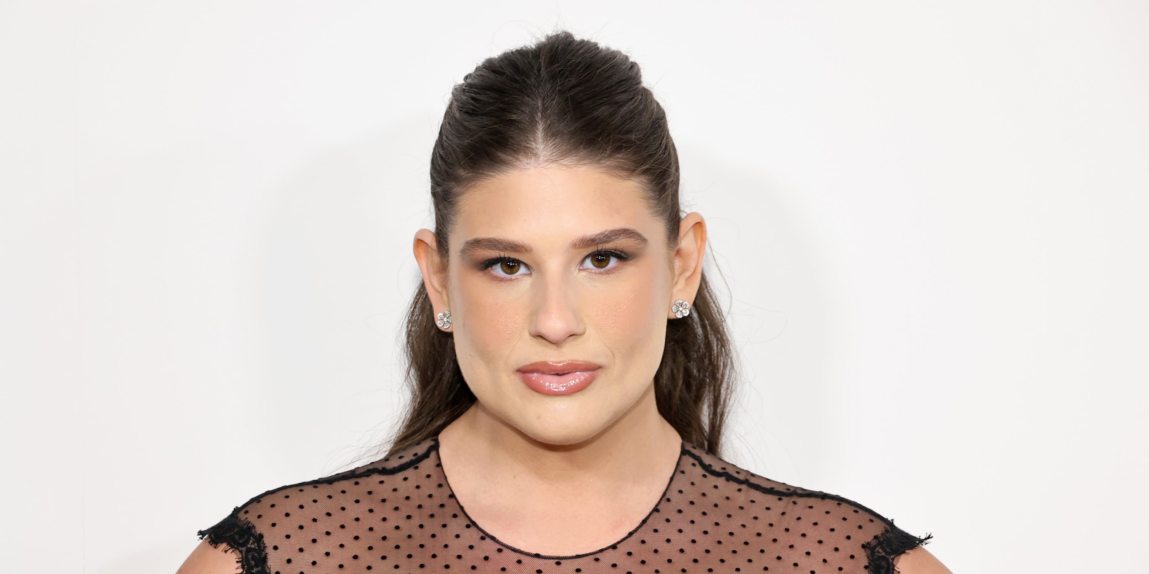 I Got Weight-Loss Surgery Like Remi Bader — No One Deserves the Shame