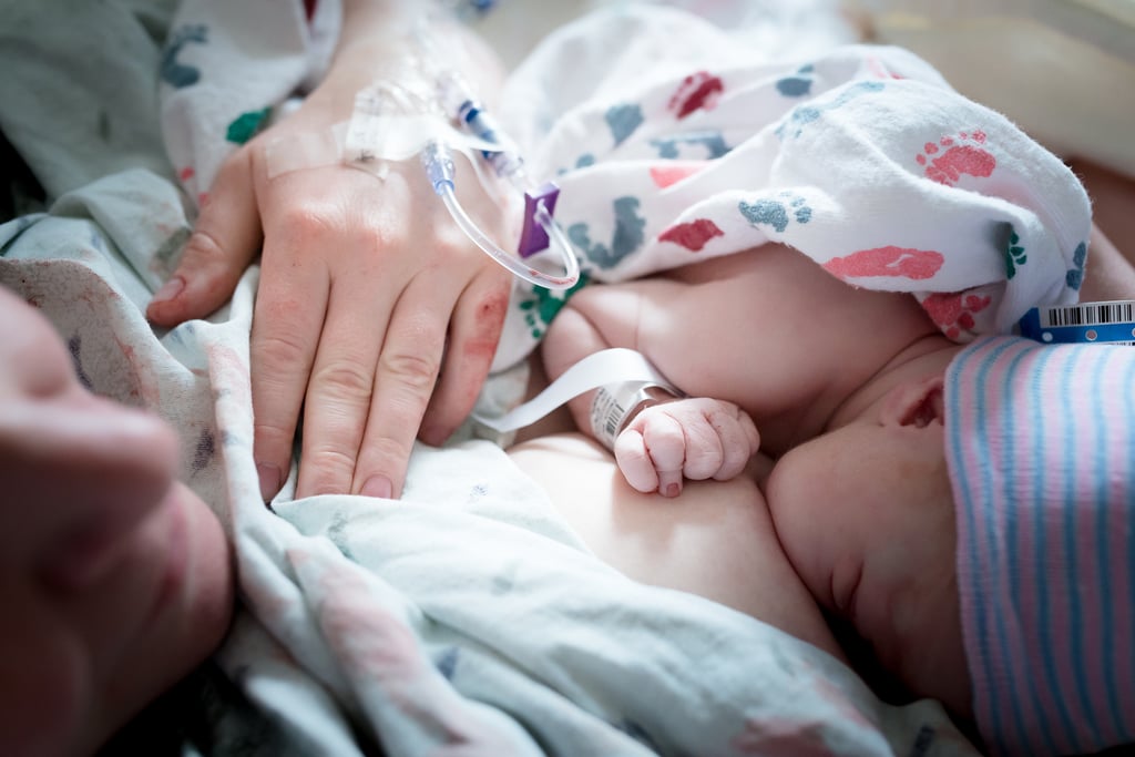 Baby Born With Umbilical Cord Wrapped Around Her Stomach