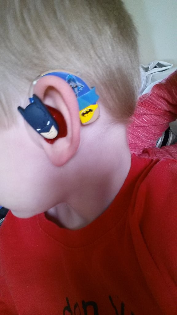 Mom Creates Superhero Hearing Aids For Son