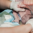 You've Probably Never Seen a Baby Born Inside Its Amniotic Sac Before — and It's Breathtaking