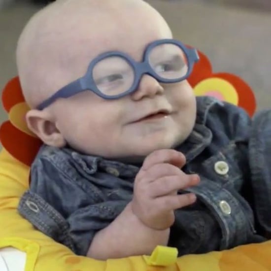 Baby With Eye Condition Sees For First Time