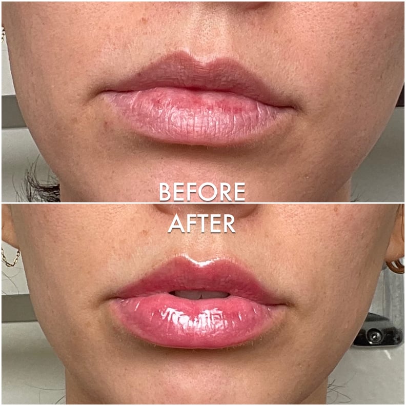 Dior lip plumper before and after new arrivals