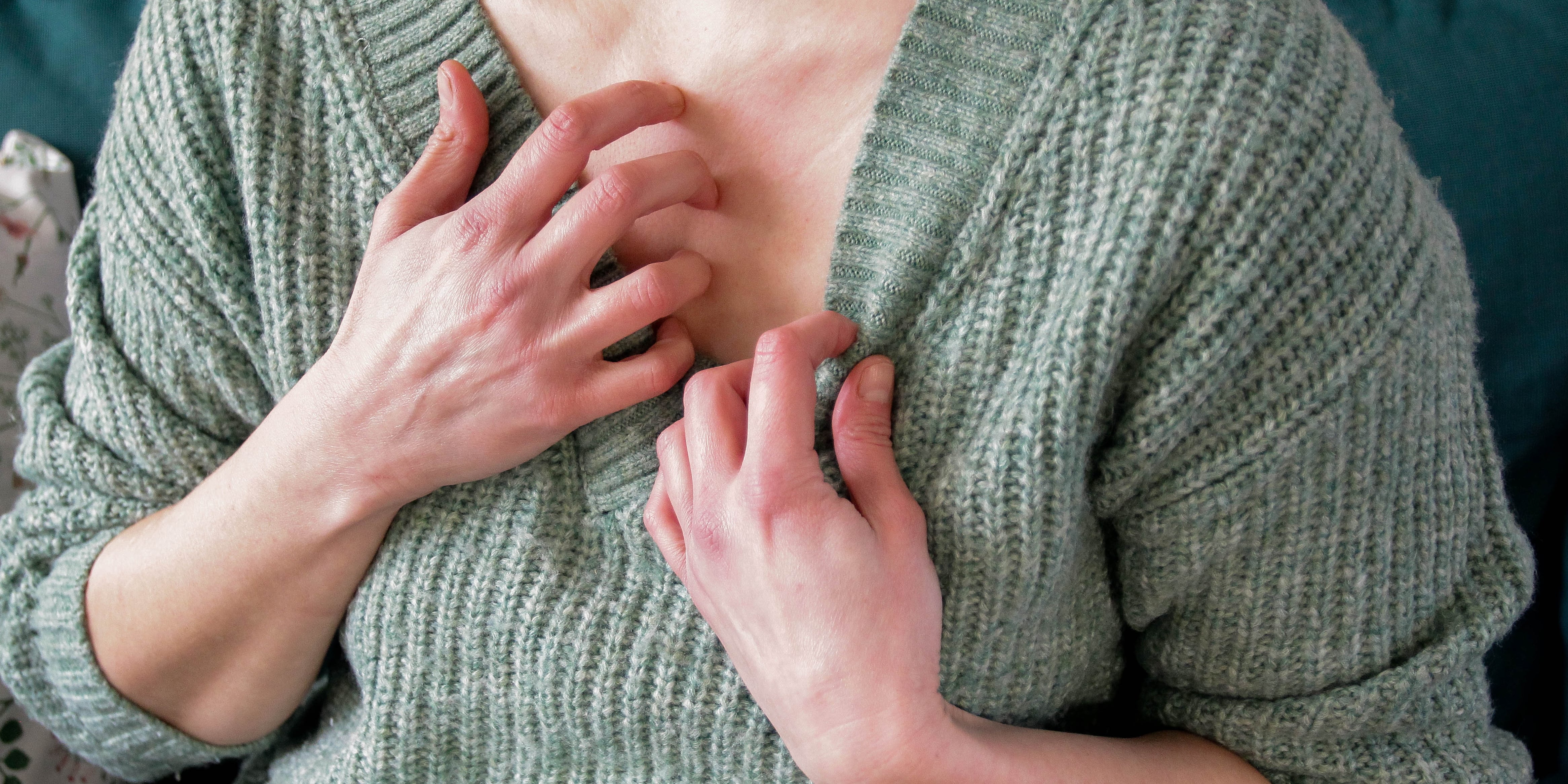 Molluscum Contagiosum: Causes, Symptoms, Treatments - Vimarsana News