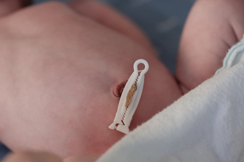 Newborn baby's belly button with umbilical cord, close up