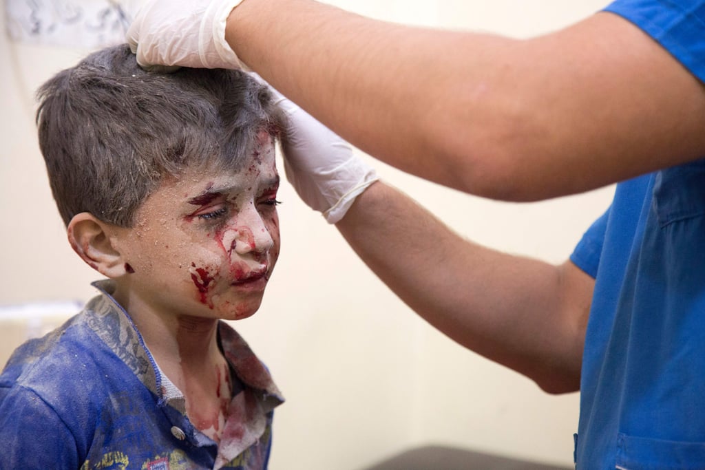 A doctor treats a young boy following an airstrike in eastern Aleppo.