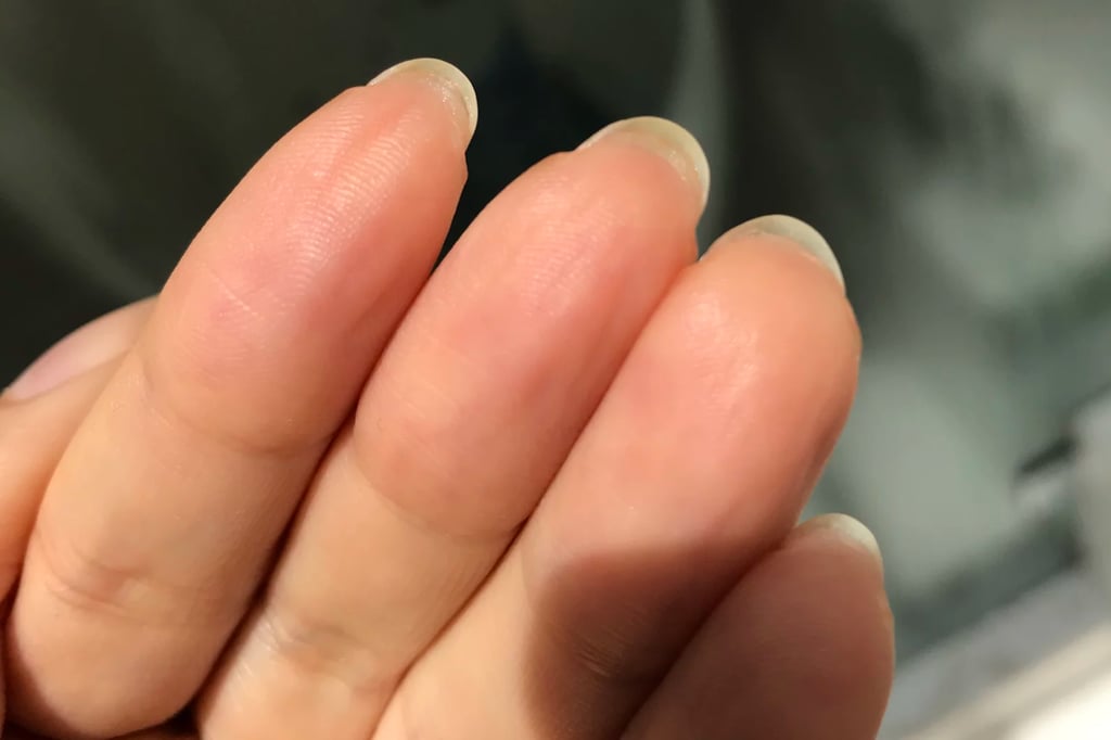 Hyponychium: Experts Explain Skin Growing Under Your Nails