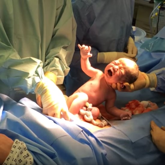 Baby Delivers Itself Via Natural C-Section Procedure