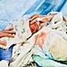 What to Expect From a C-Section