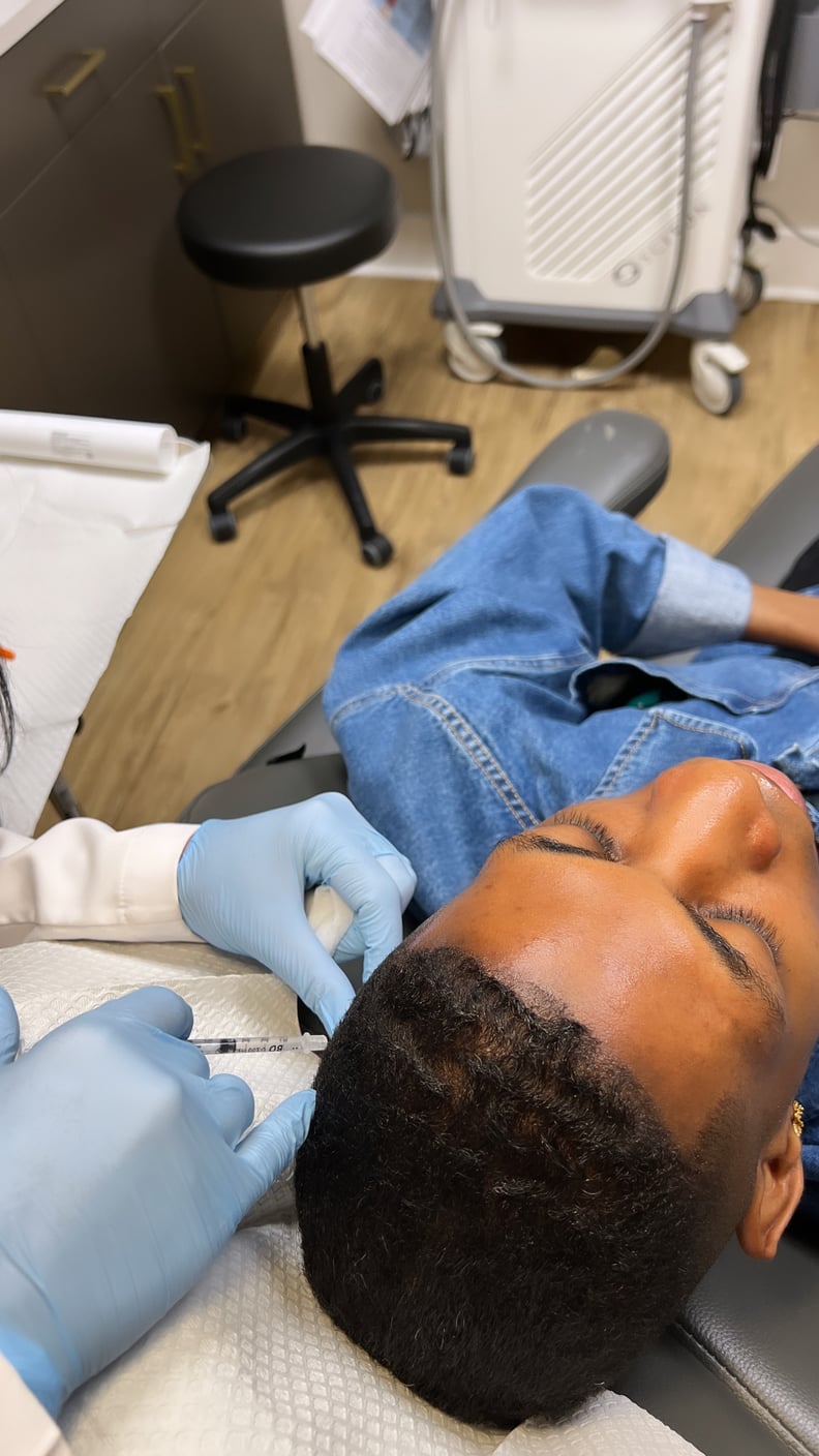 botox for edges review