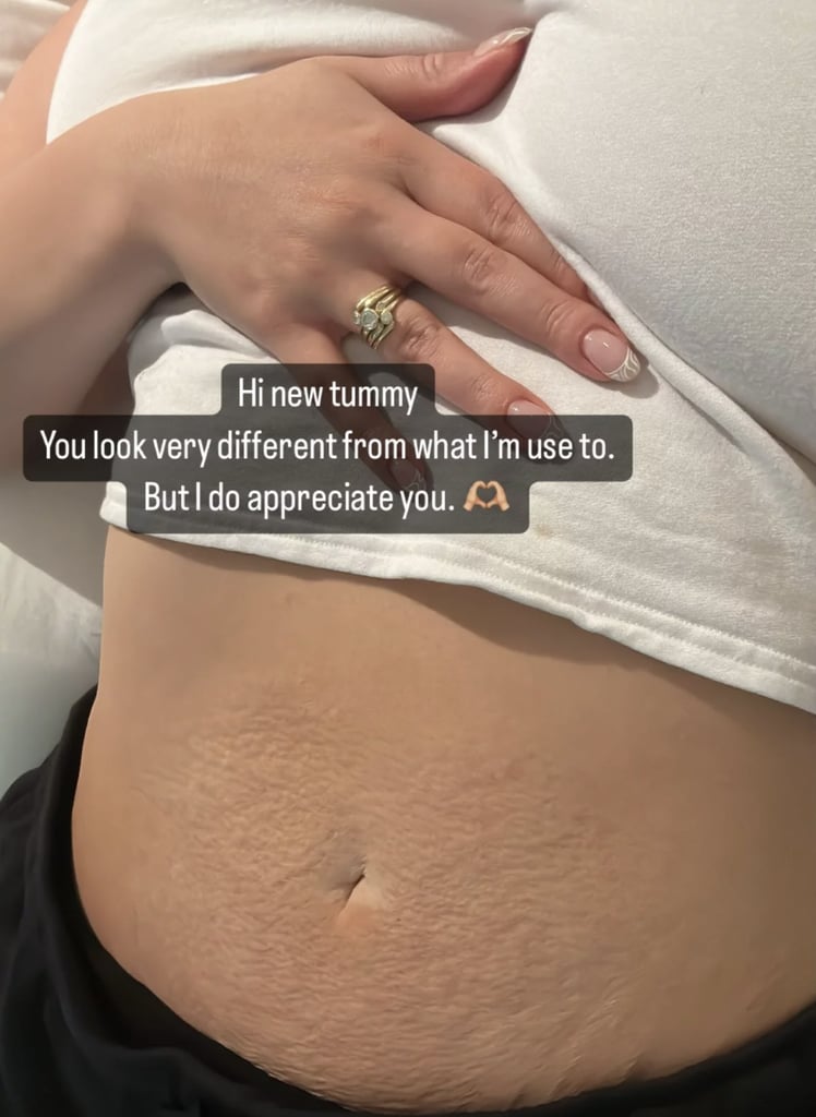 Ashley Graham Shows Appreciation For Her "Very Different" Postpartum Tummy