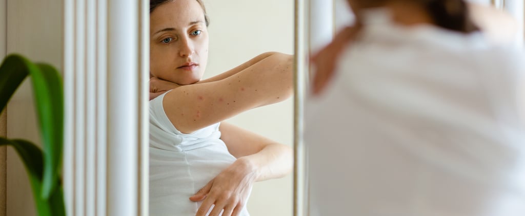 湿疹是什么和如何对待它?
