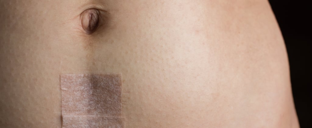 What Not to Say to Someone Who Had a C-Section