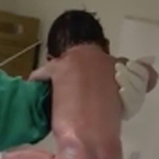 Video of Newborn Walking in the Delivery Room