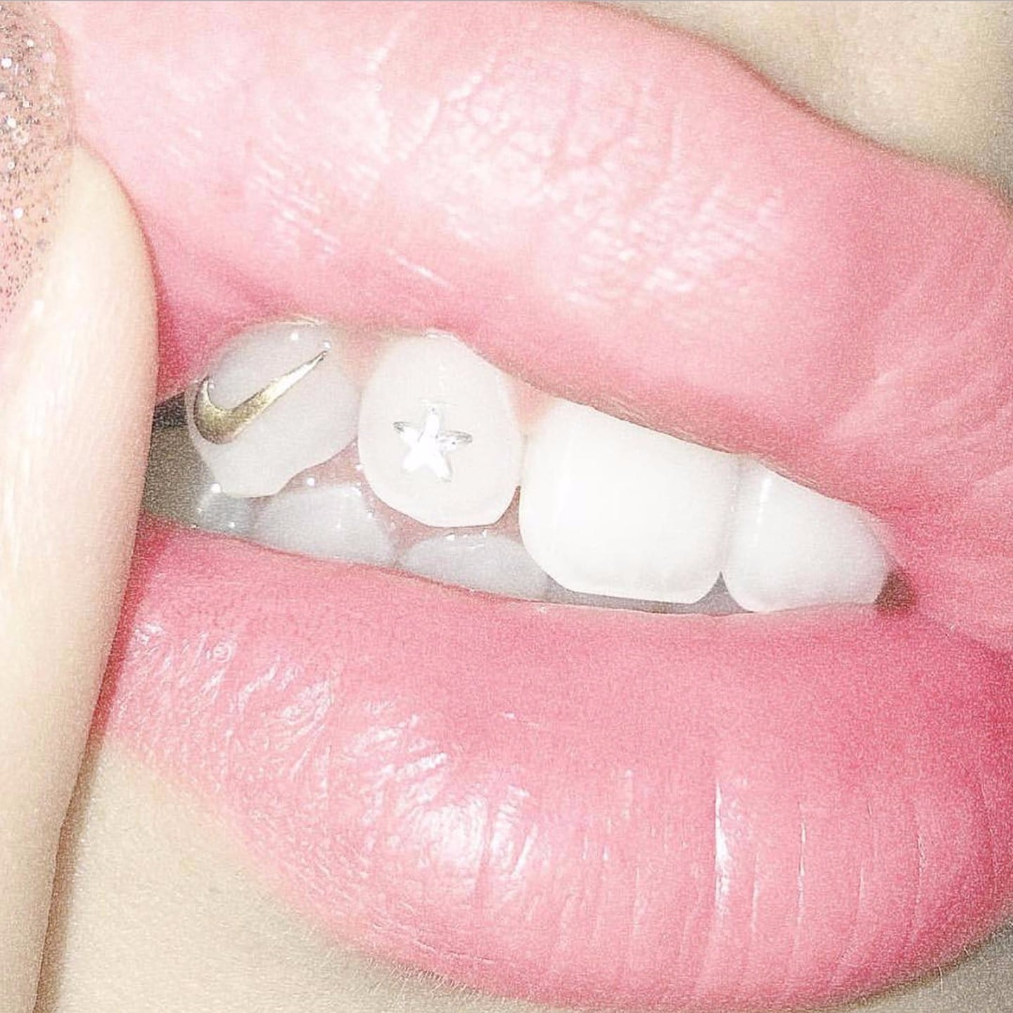 Tooth gems are making a comeback, so could this be the most painful - and  dangerous - beauty trend ever?