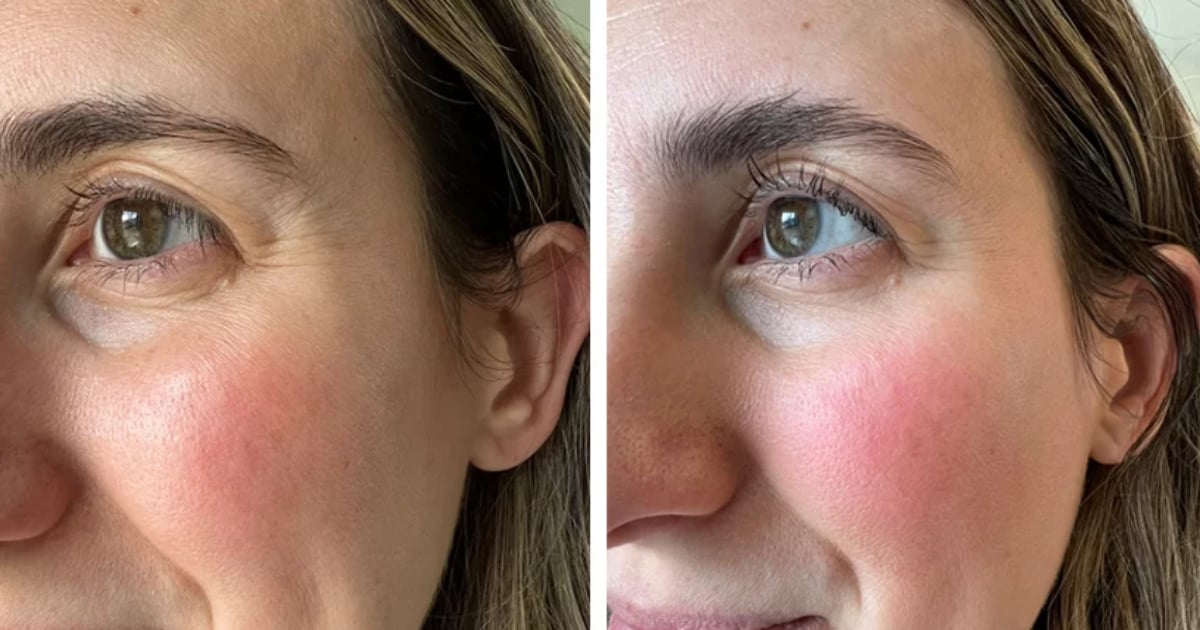 You Have to See the Results of This Blurring Eye Cream to Believe It