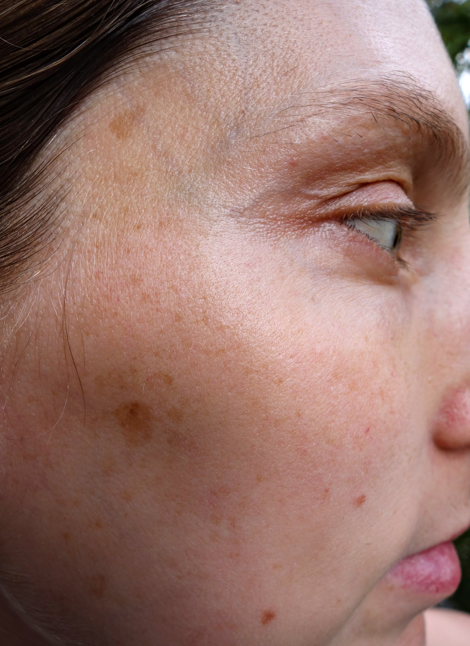 What Is the Pregnancy Mask? | PS Beauty
