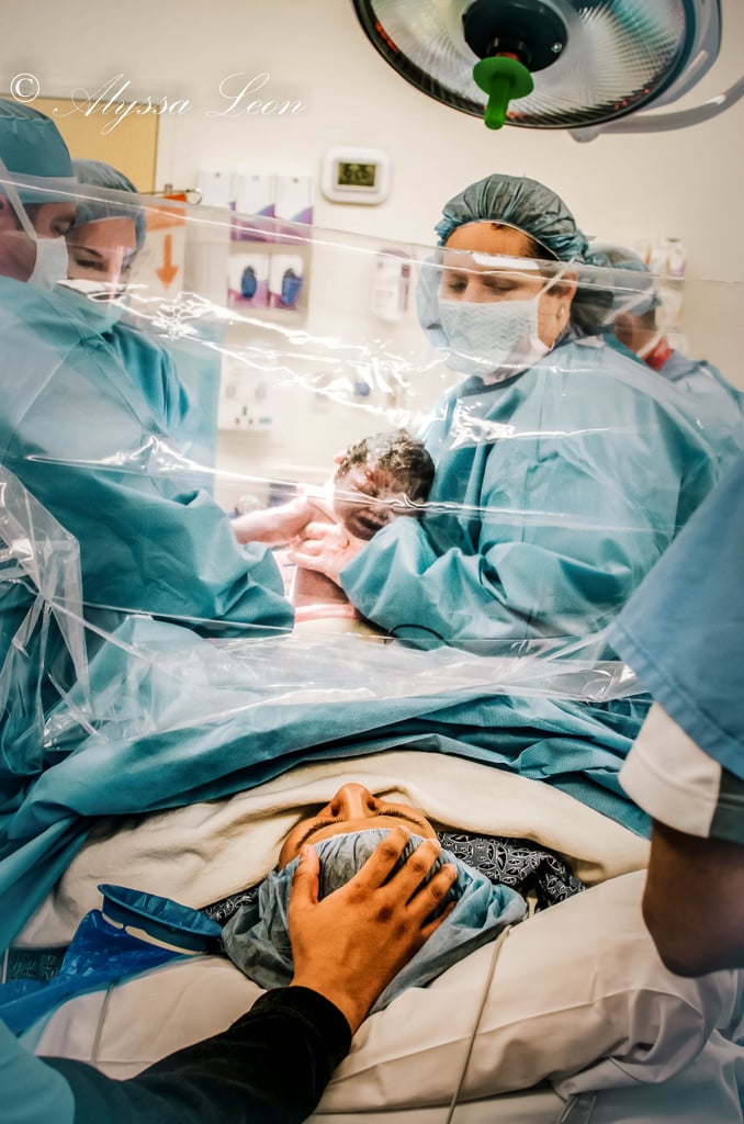 Clear Drapes Family Centered C-Section Birth Photos