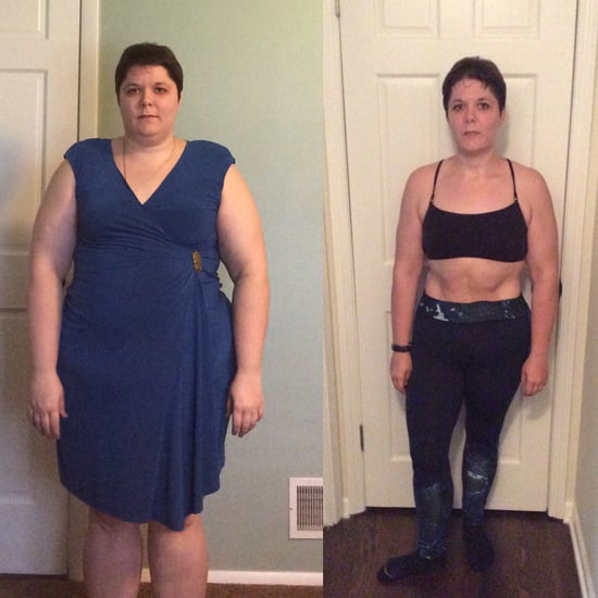 Gastric Sleeve Surgery Weight-Loss Transformation