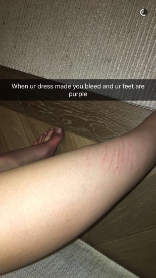 Kylie Jenner's Scratches From Her Met Gala 2016 Dress