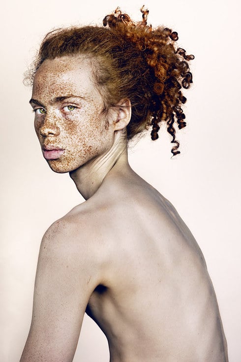 Photos of People With Freckles