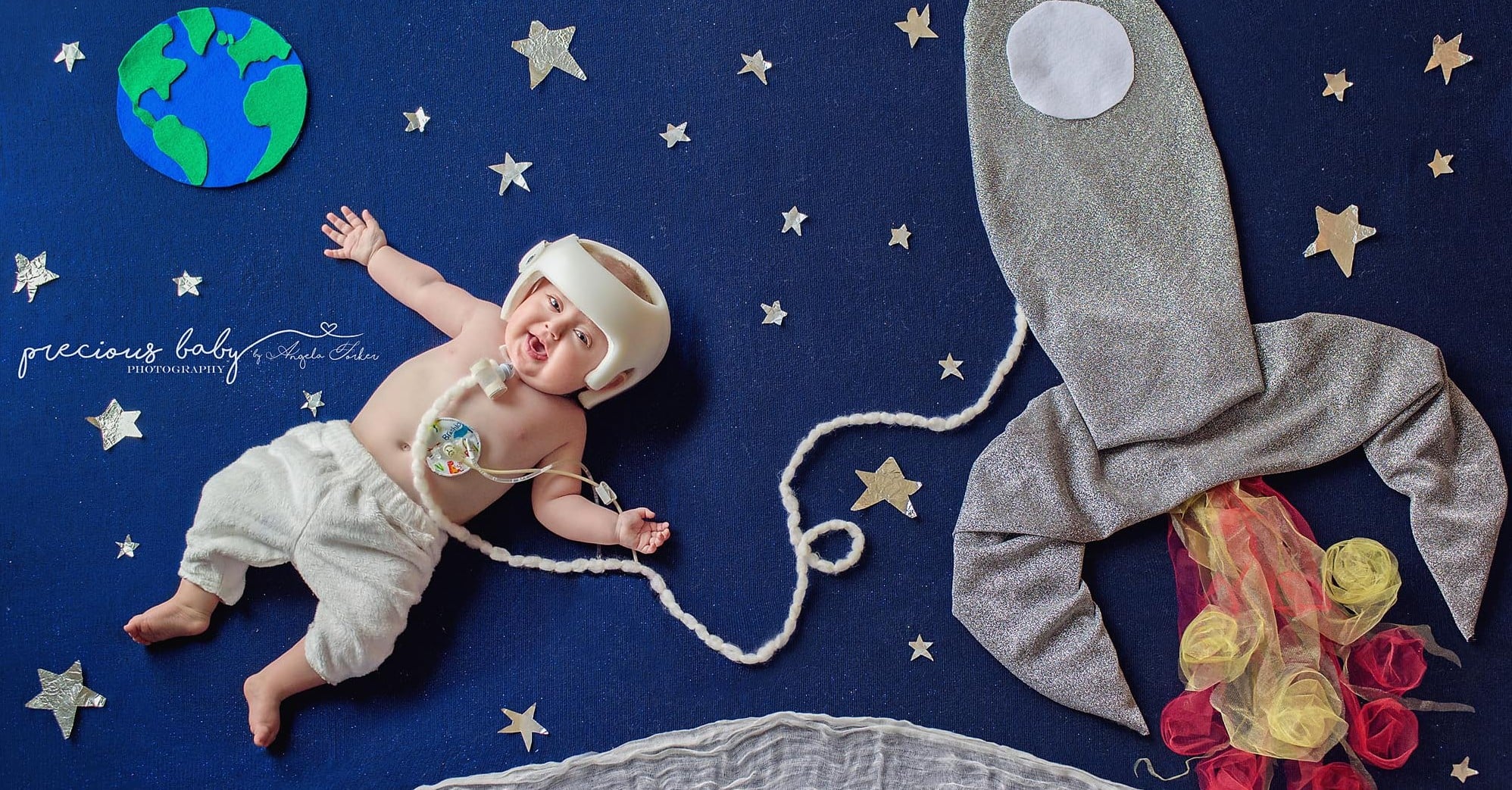 Photos of Babies With Special Needs on Floor Backdrops POPSUGAR