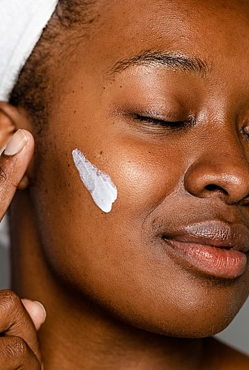 Hyperpigmentation on Black Skin: Tips and Treatments