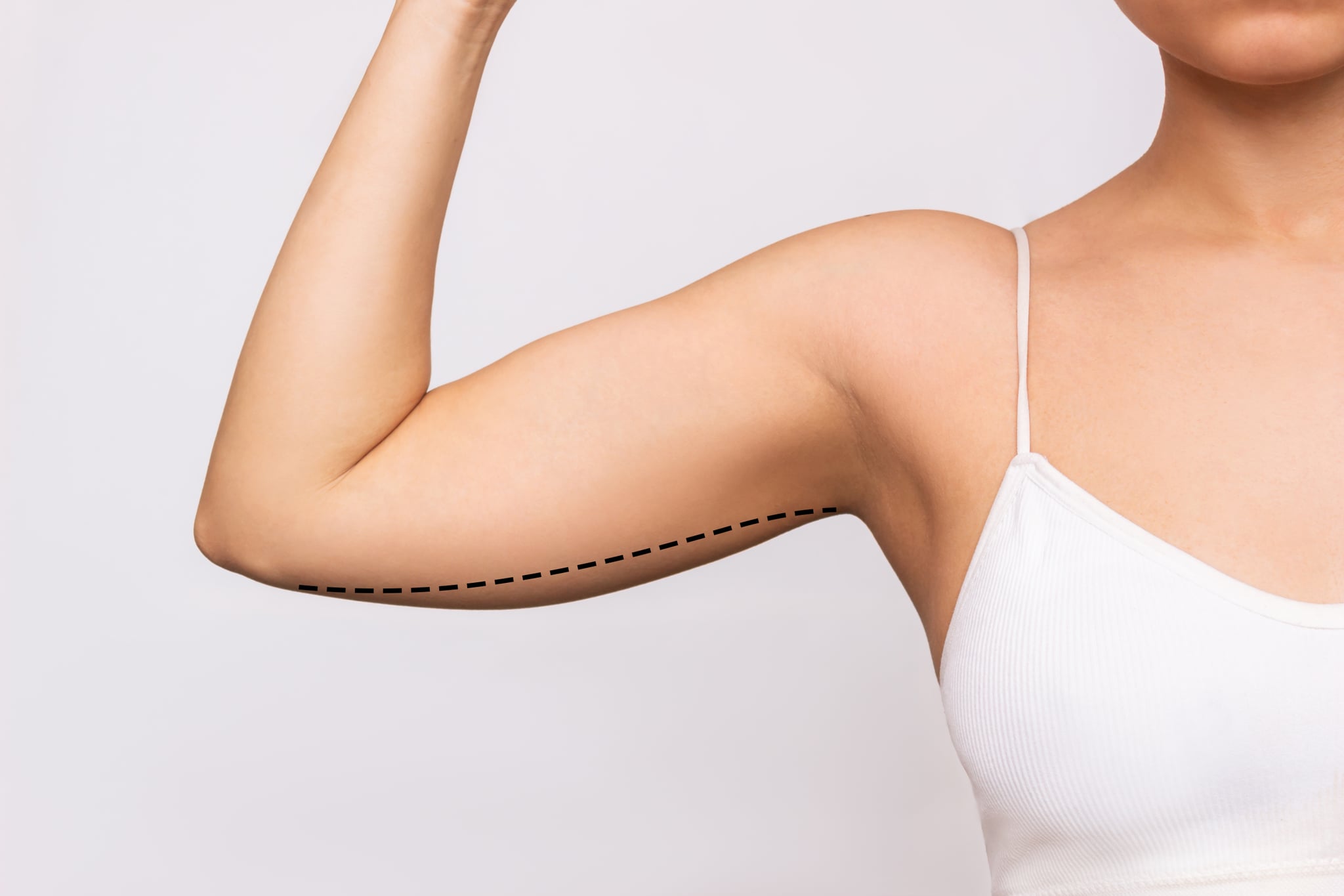 Cropped shot of a young woman with excess fat on her upper arm with marks for liposuction or plastic surgery isolated on a grey background. The loose and saggy muscles. Overweight. Beauty concept