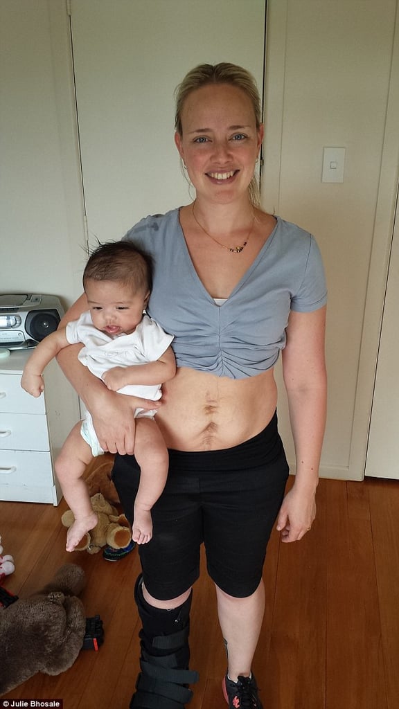 10 Weeks Postpartum