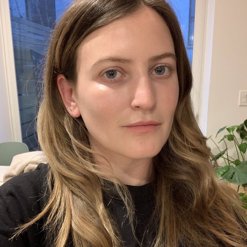 I Got Undereye Fillers, and the Results Are Game-Changing
