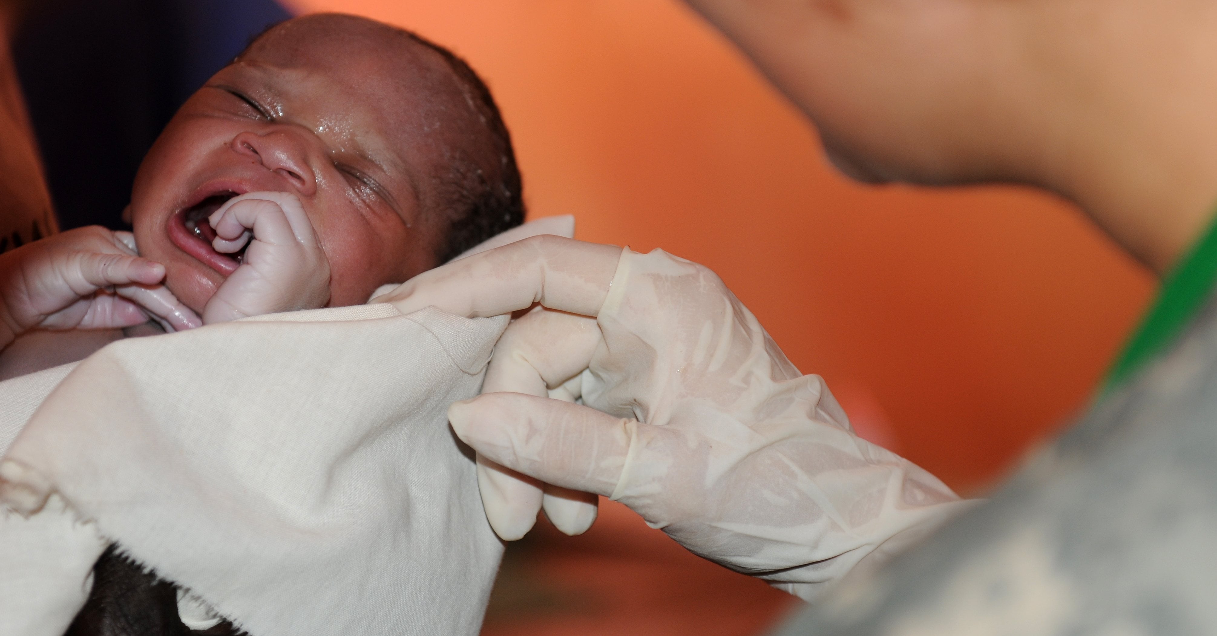 Is Having a Lotus Birth Safe? POPSUGAR Family