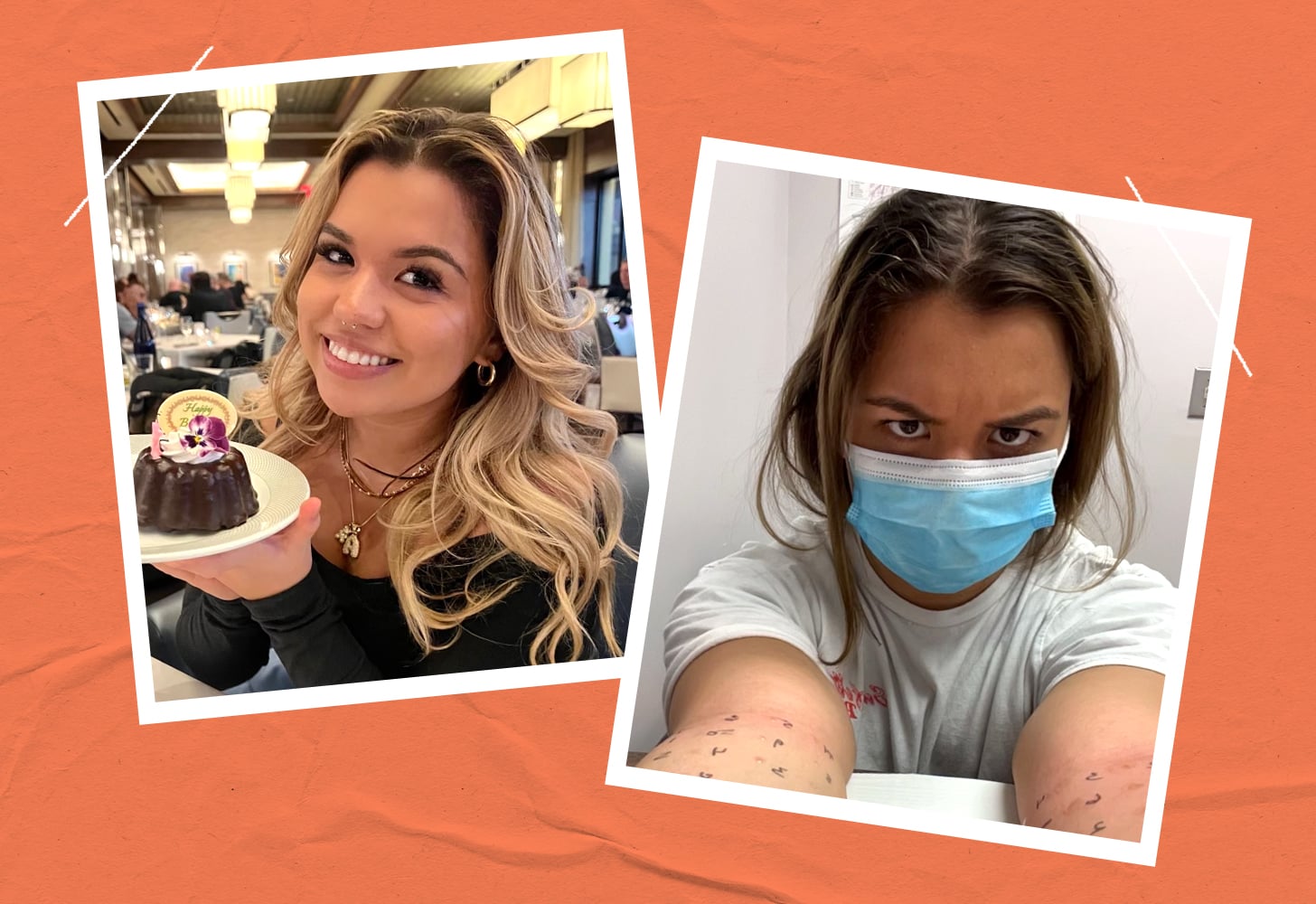 Lauren Ramos shares what it's like living with chronic allergies.