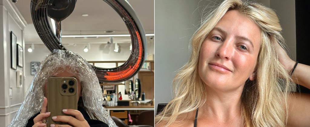 Scandi Hairline Before and After: See My Results