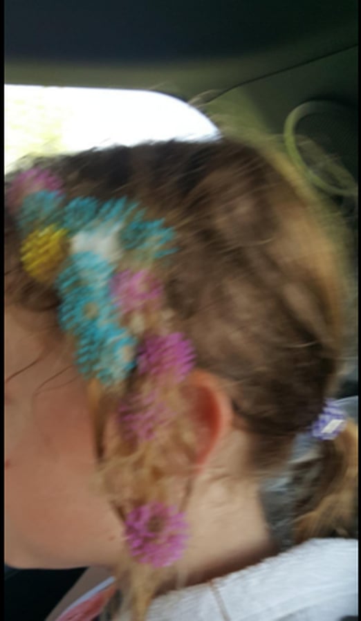 How to Remove Bunchems From Hair POPSUGAR Family