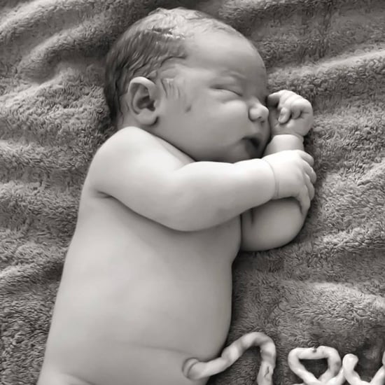 Photo of Baby Still Attached to Placenta by Umbilical Cord