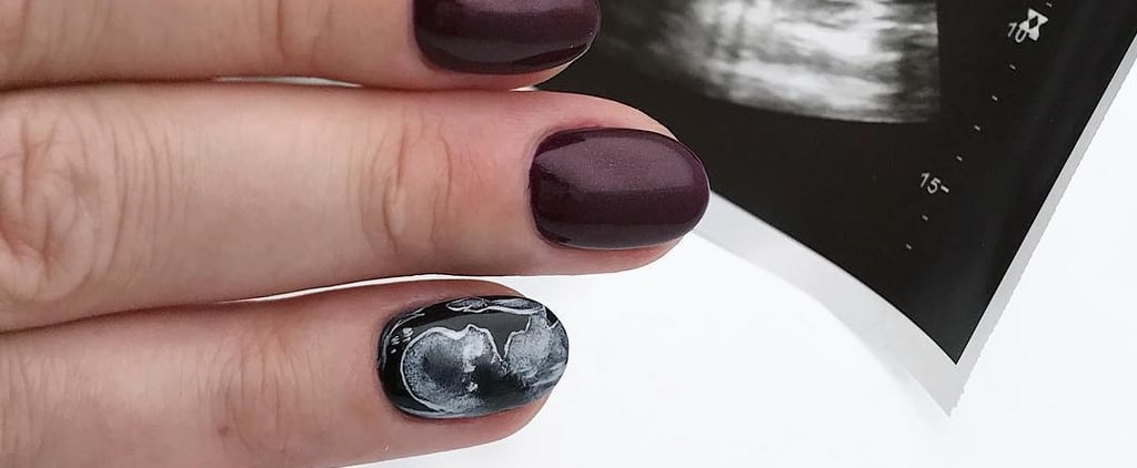 This Mesmerizing Ultrasound Nail Trend Lets You Subtly Reveal Your Pregnancy