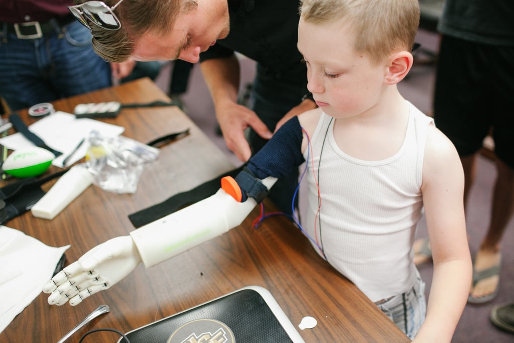 Boy Receives Prosthetic Arm From 3D Printer