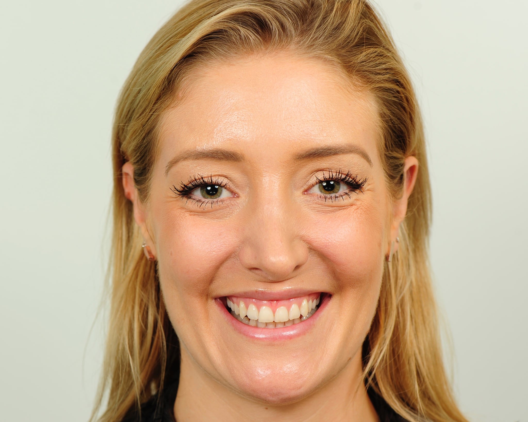 Zoom Teeth Whitening Review Before and After Pictures POPSUGAR Beauty