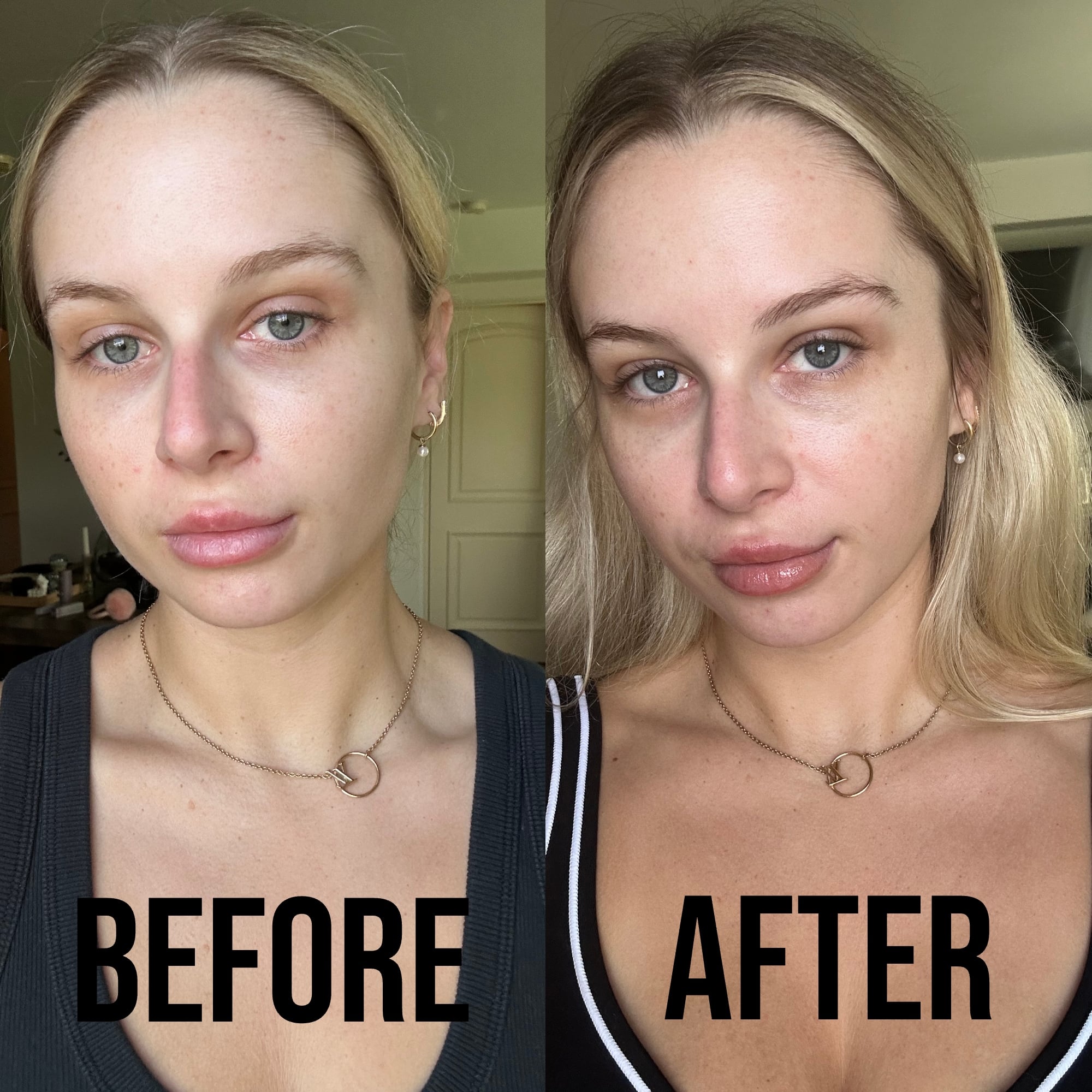 Taylor Before and After Using Dr. Brandt's Revitalizing Face Serum