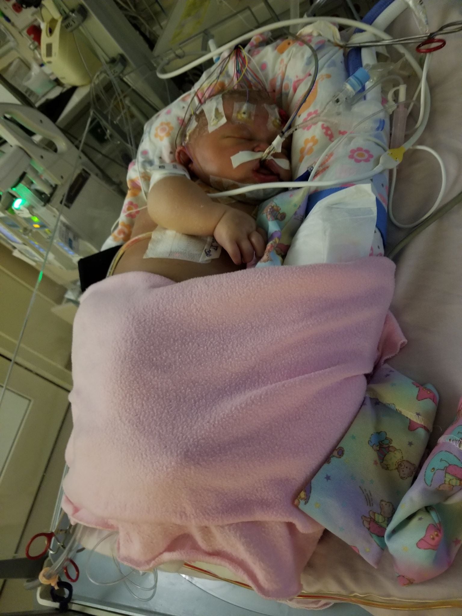 Newborn Baby Dies From Meningitis HSV-1 | POPSUGAR Moms