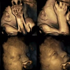 Fetus Responding to Mom Smoking