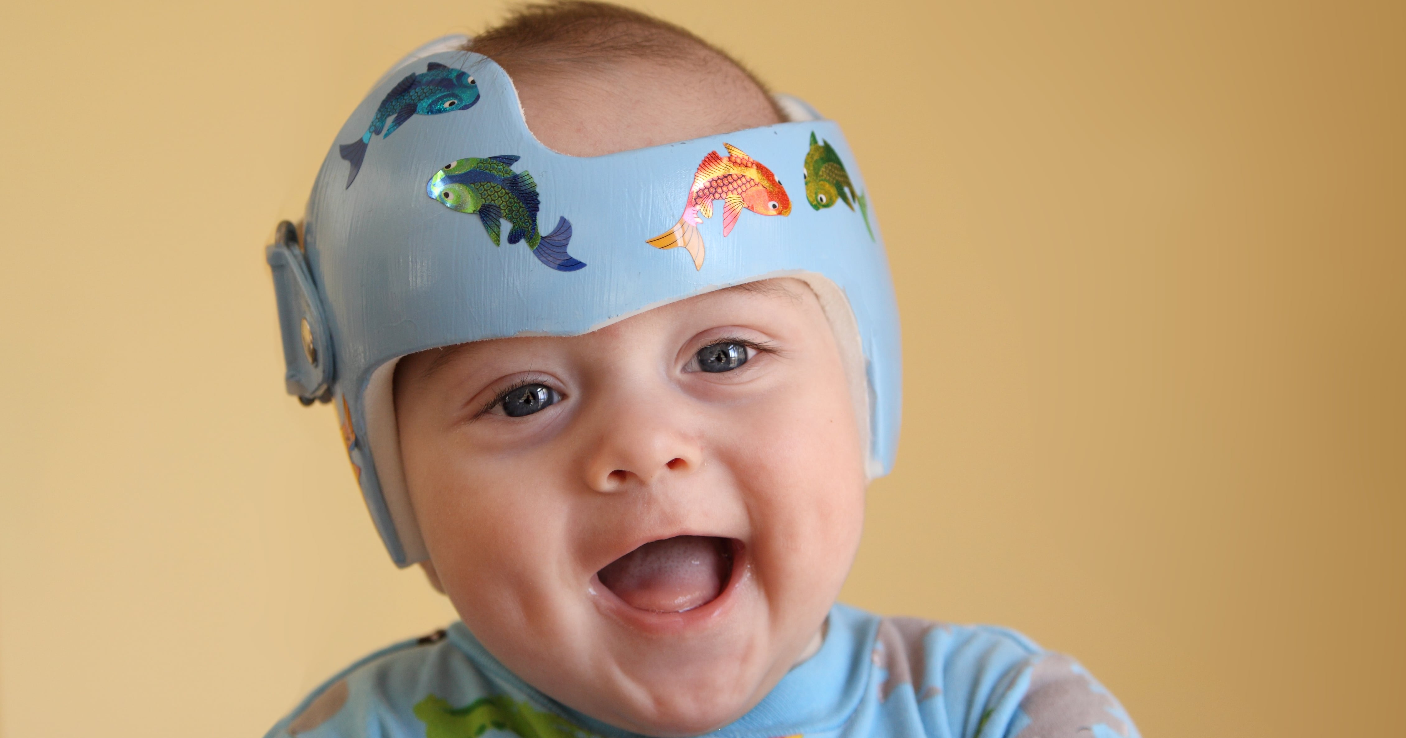Are Baby Helmets a Cure For Flat Heads, or Unnecessary? - Vimarsana News