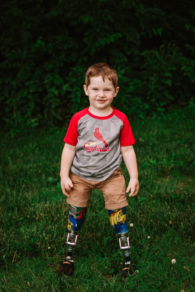 Photo Shoot of Toddler Who Lost Both Legs