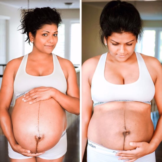 Anupa King Side-by-Side Bump Photo Pre- and Postpregnancy