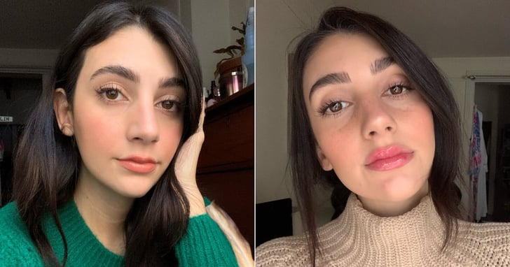 Lip Envy Unveiled: Before and After Lip Filler Stories that Inspire