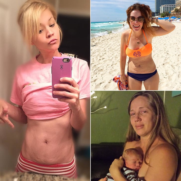 Postpartum Body Stories From 2015