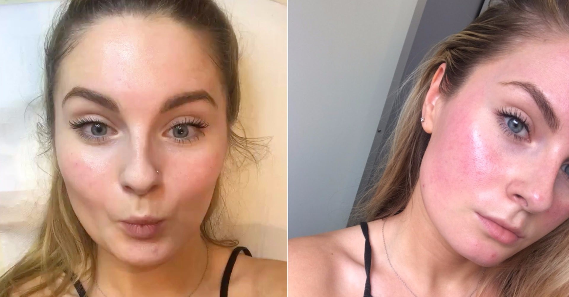 Dermaplaning Hair Regrowth, Explained POPSUGAR Beauty